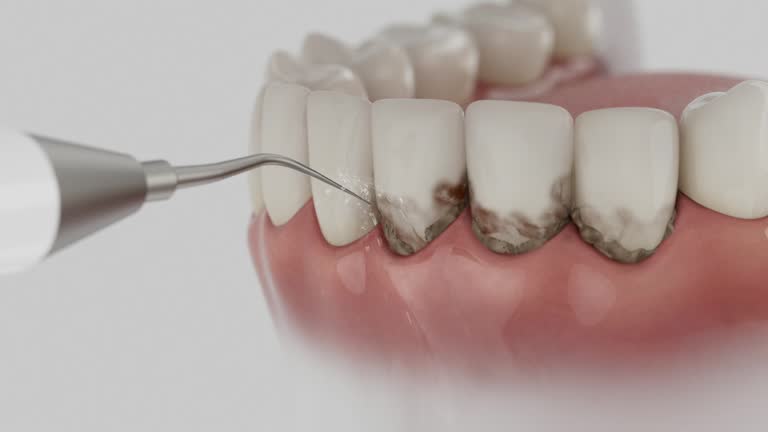 Reliable Teeth Cleaning And Checkup contractor in Lowndes County County, AL by Dentist Open Now